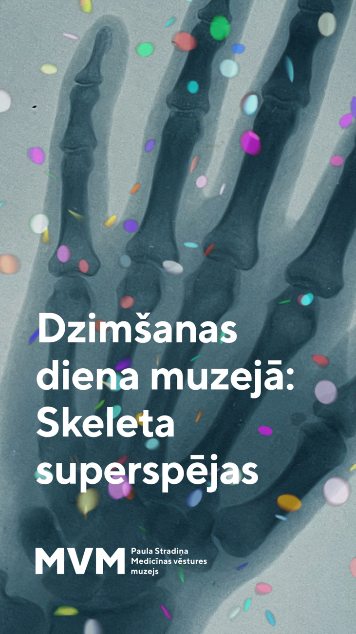 Cilvēka rokas rentgena attēls ar krāsainiem konfeti, kas uzklāti virs tās.