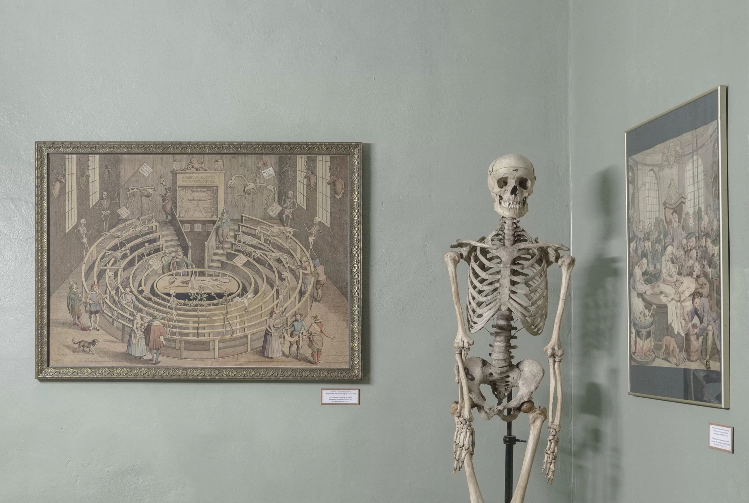 A skeleton surrounded by two paintings of public scenes of operations.